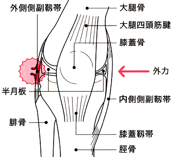 膝の関節を支える４本の靭帯について 位置 名称 機能 起こりやすいケガなど