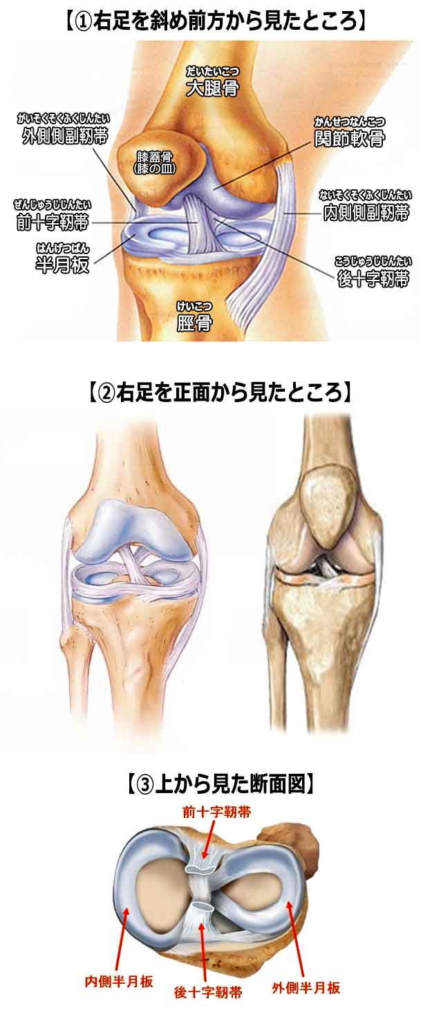 膝の痛みの原因となる タナ障害 棚障害 タナ症候群 特徴 症状 治療