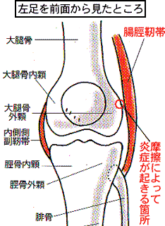 腸脛靭帯と骨の摩擦箇所